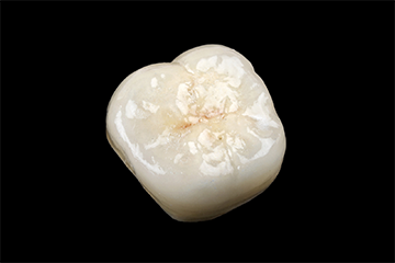 フルプレミアムジルコニア